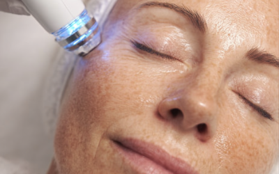 Anti-age kasvohoidot: mitkä hoidot oikeasti kiinteyttävät ihoa?